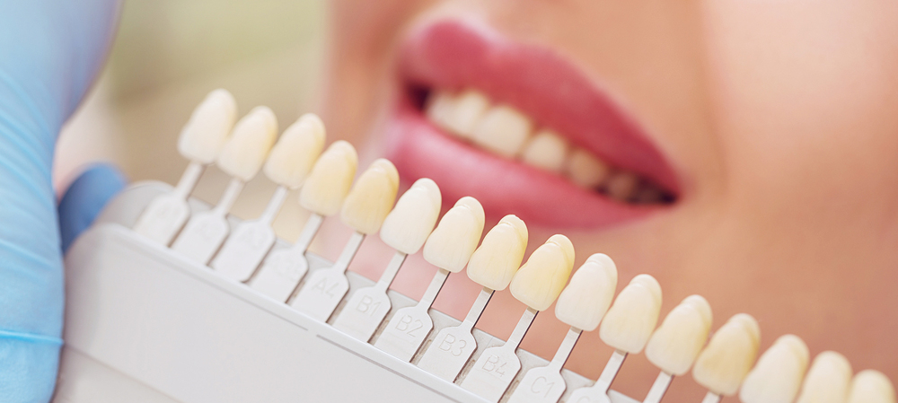 Teeth Whitening Law